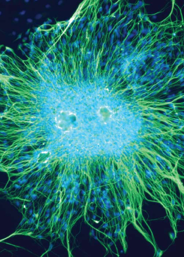 Human Embrionic Stem Cell Neurons, Dieter Egli, PHD, Senior Research Fellow, The New York Stem Cell Foundation